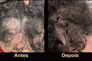Tratamento clínico avançado